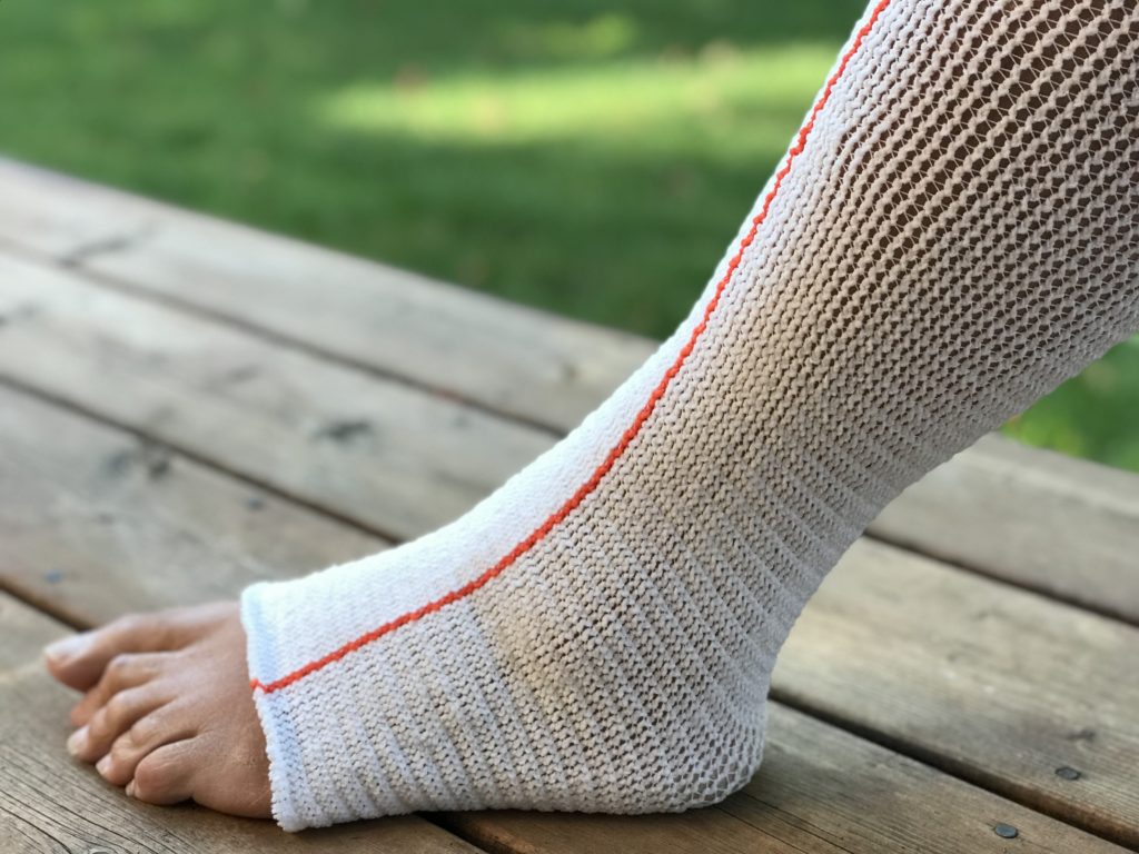 Edemawear Lite Lymphedema Stockinet Medium Max Limb 90cm Length 86cm For Tender Skin (Orange)