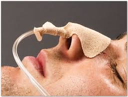 Dale Nasogastric Tube Holder, One Size Fits Most