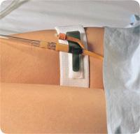 Foley Cath Holder, Leg Band 2in X 19.5in