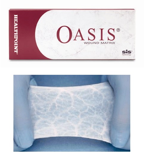 Oasis Wound Matrix Fenestrated, 7cm X 20cm (Non-Returnable)