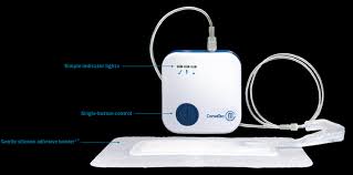 Avelle Npwt System (12x21)Cm (4x13)Cm Inner Pad W/ Hydrofiber Core & Silicone Adhesive Border